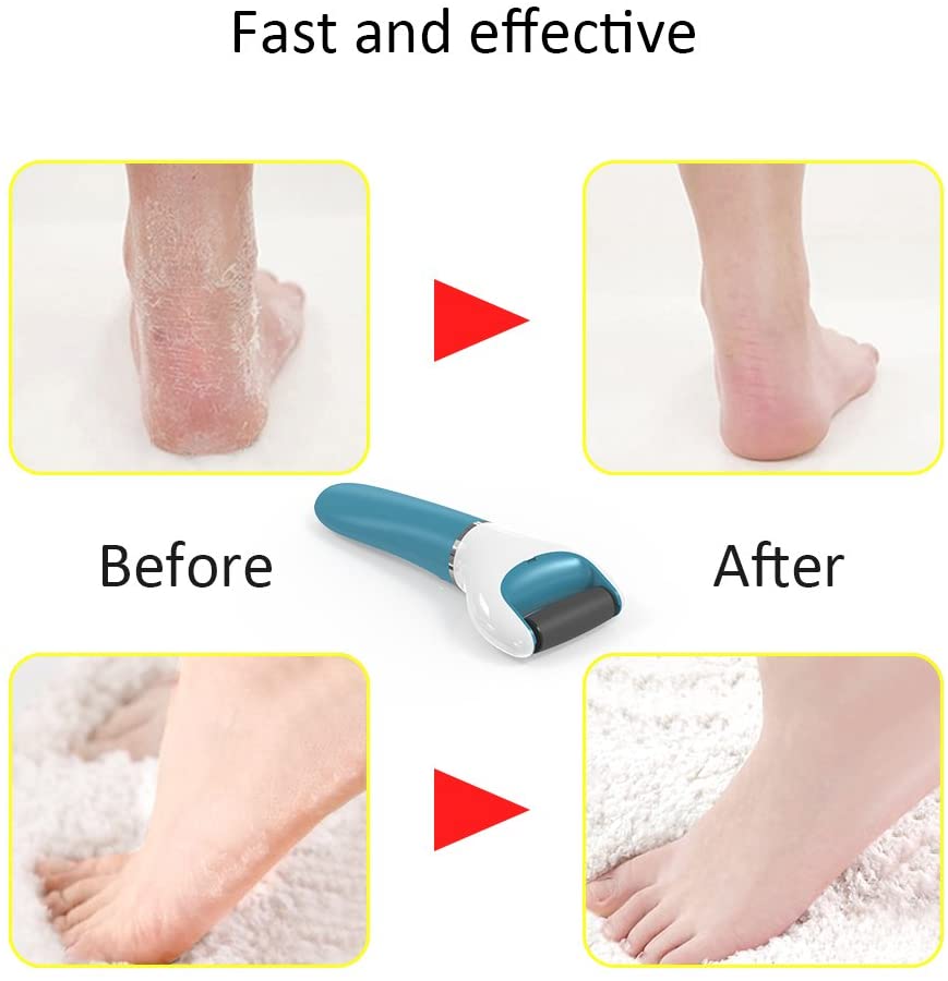 Electric USB Rechargeable Foot Grinder Heel File Grinding Exfoliator